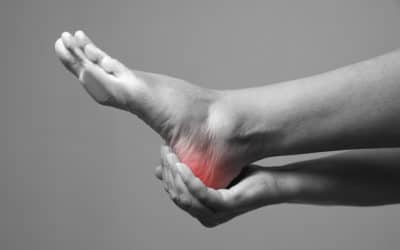 Common Mistakes When Dealing with Plantar Fasciitis